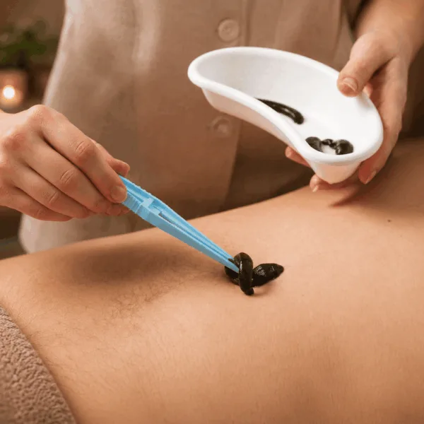 Leech Therapy